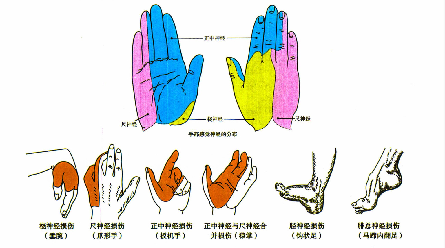 手掌神经支配区域